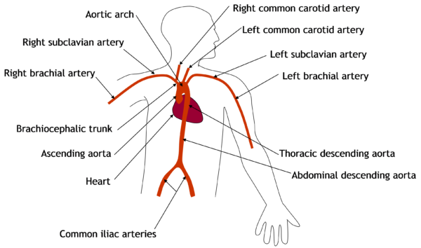 Arteries of the upper body
